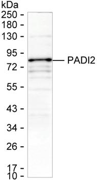 PADI2